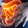 Welt-IBD-Tag: Die Rolle der Darmmikrobiota bei Dysbiose verstehen